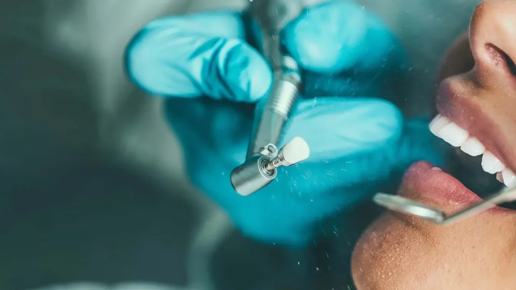 Scaling & Polishing: Why Your Gums Need It Every Six Months