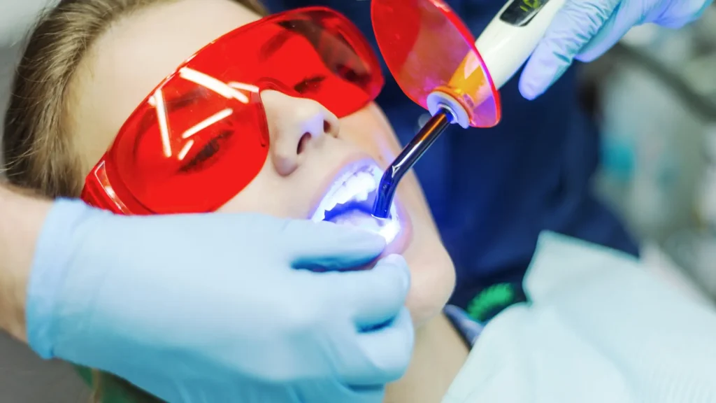 Tooth-Coloured (Laser-Assisted) Fillings: Natural Repair Without Metal